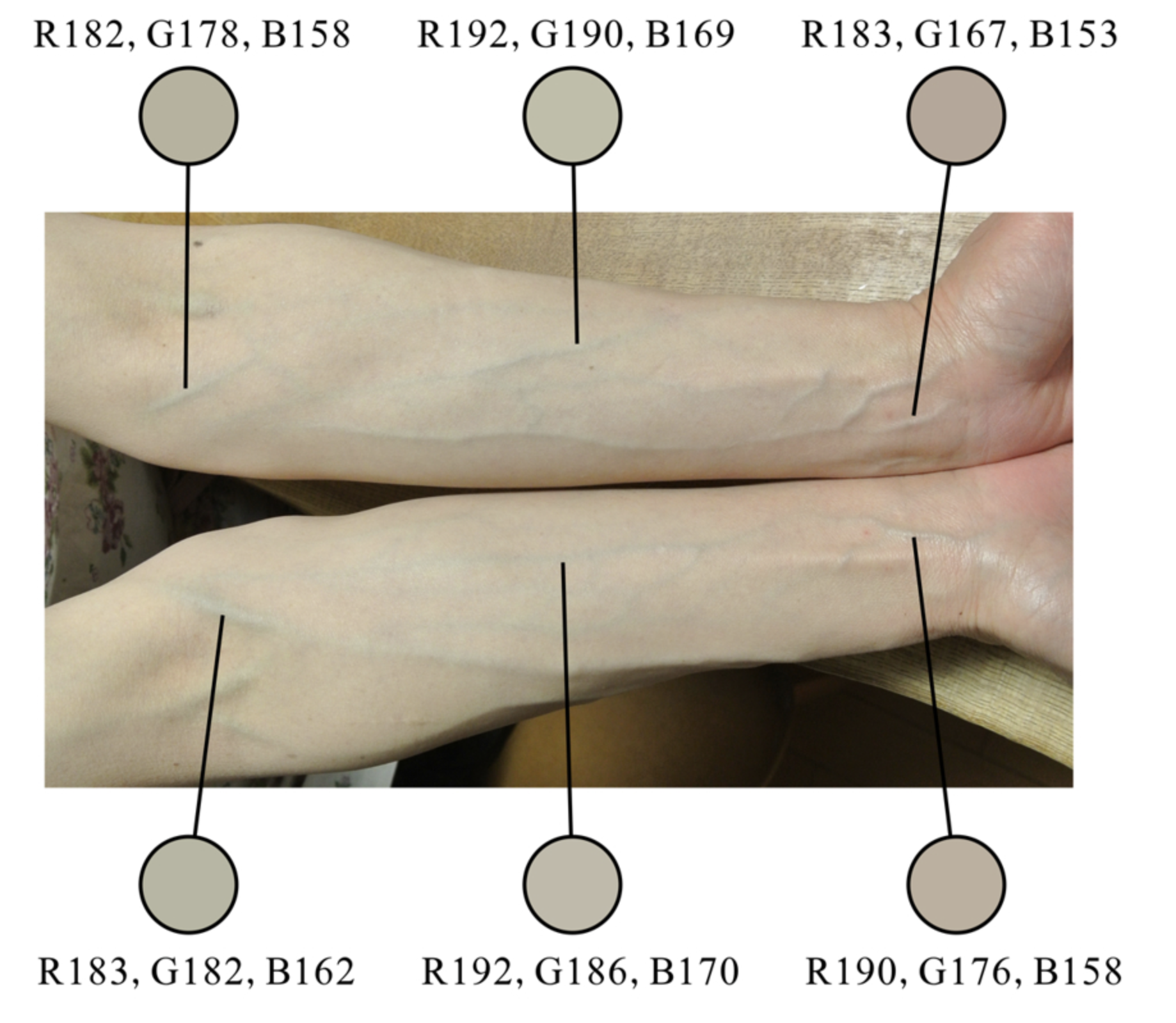 slighty red veins that look blue